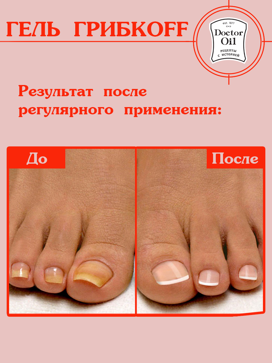 Крем для ног ГрибкOFF Doctor Oil, 30 мл