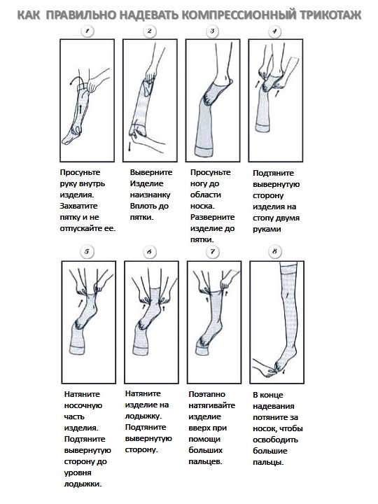Антиэмболические чулки 1 кл компресc на резинке Relaxsan Medicale (M0370А) цвет белый р XL x1