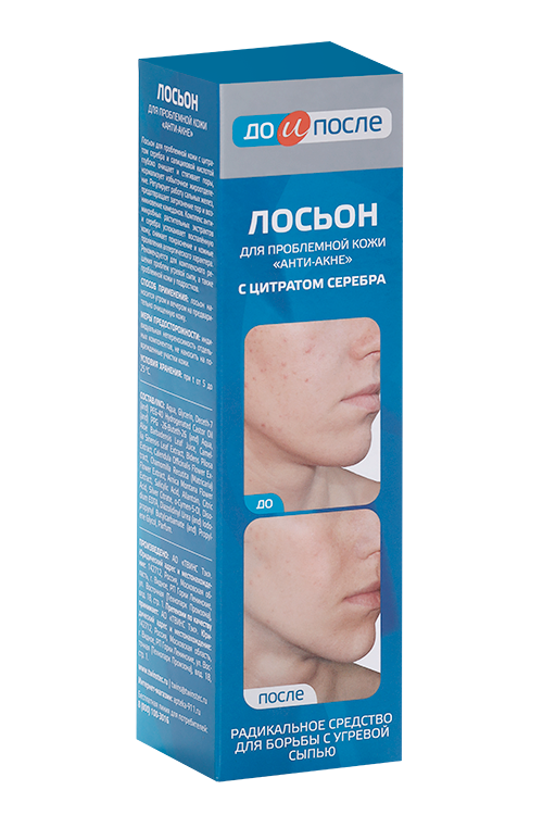 

Лосьон До и После Анти-Акне д/проблемн кожи с цитратом серебра, 200 мл