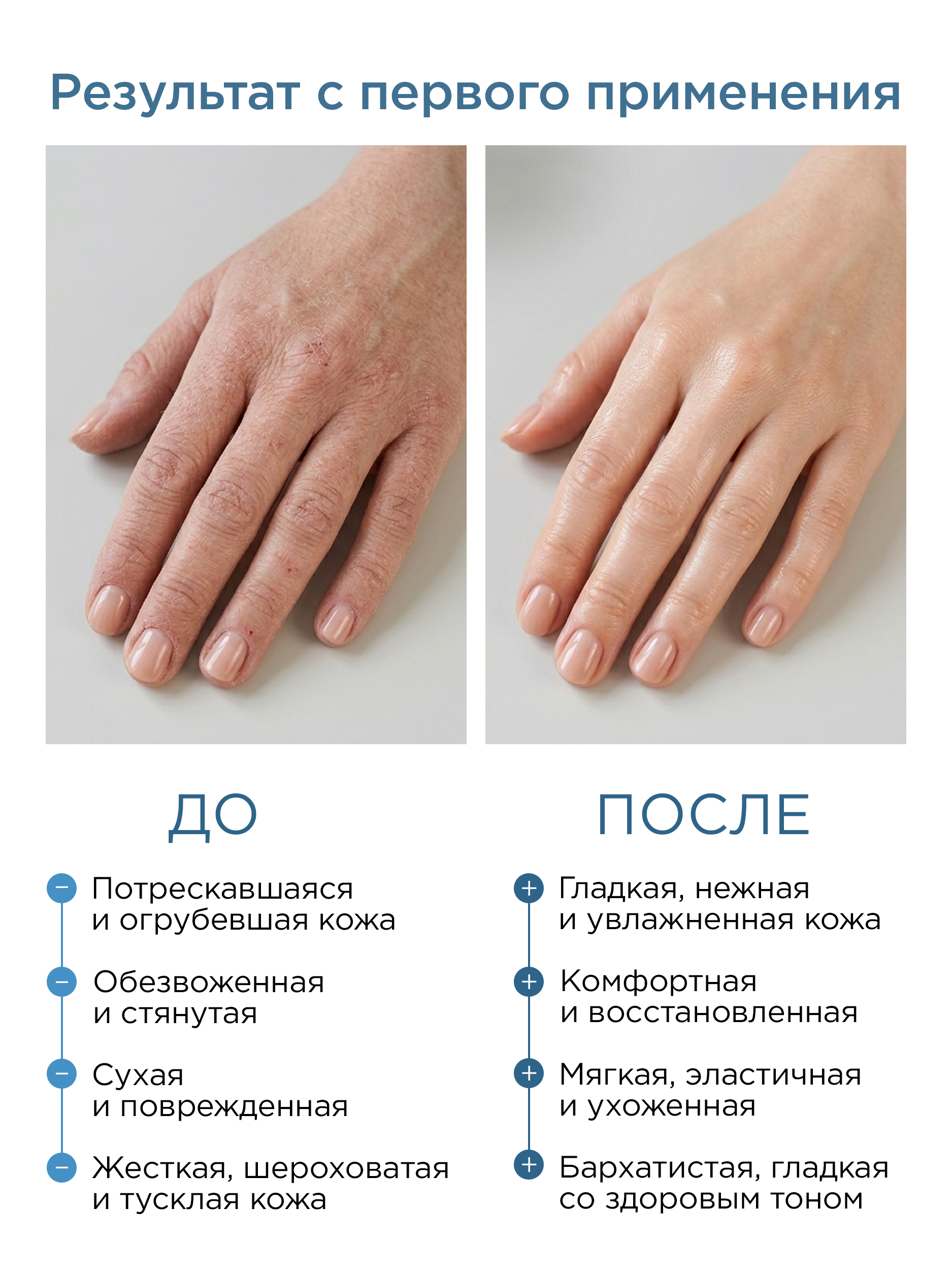 DREAM NATURE Крем для рук с мочевиной, 70 мл