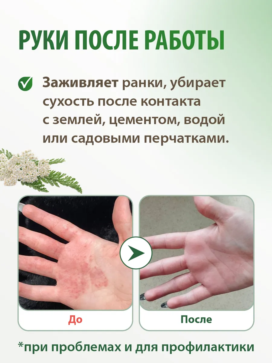 Крем Акрустал Пихтовая Формула 65 мл для ухода за сухой и пораженной кожей (при зуде, шелушении, способствует заживлению трещин)