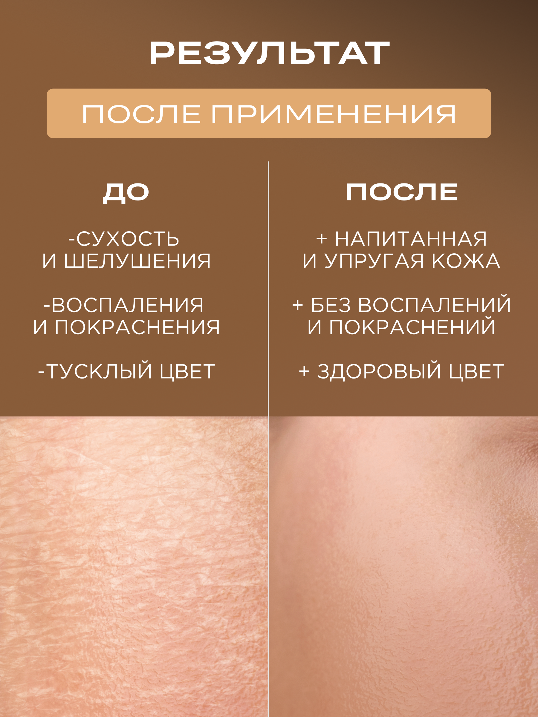 Тоник для лица увлажняющий с мочевиной, HELDI, 300 мл