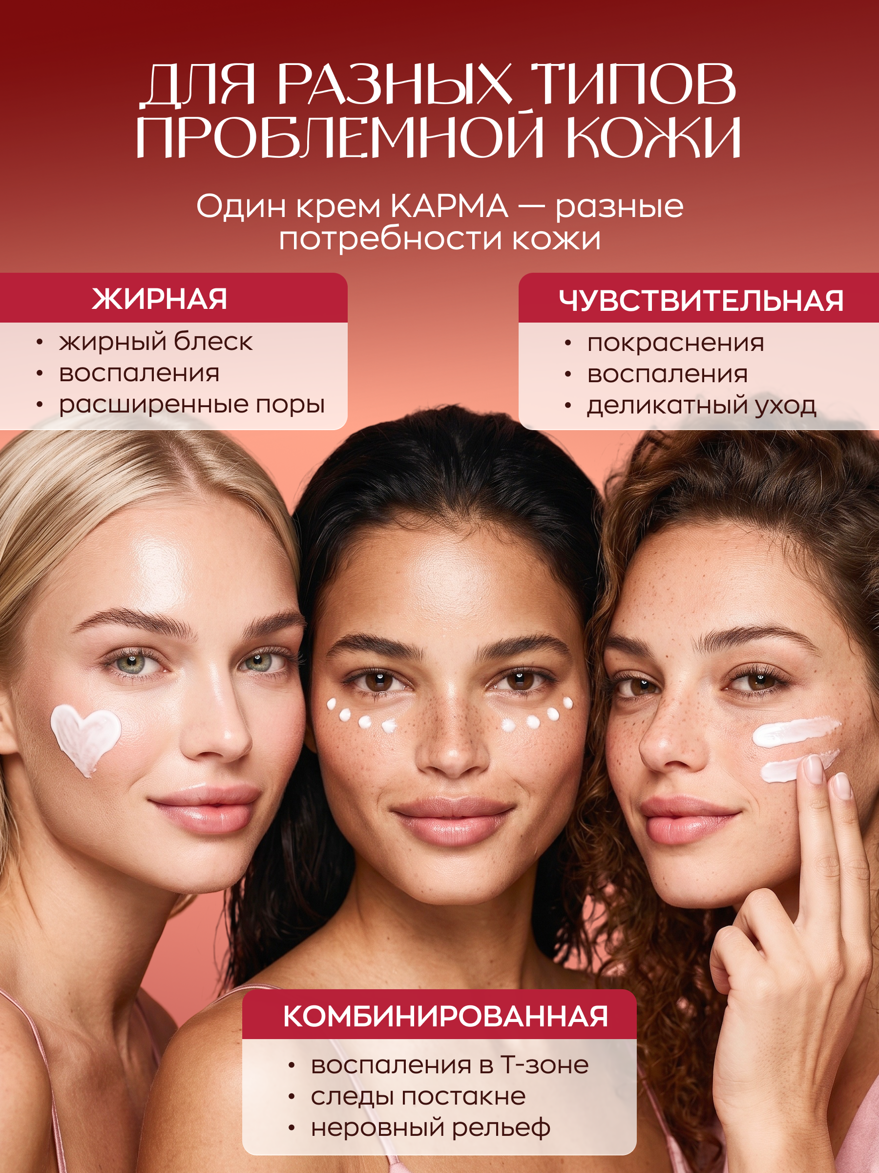 Крем для жирной кожи лица анти-акне, КАРМА, 150 мл