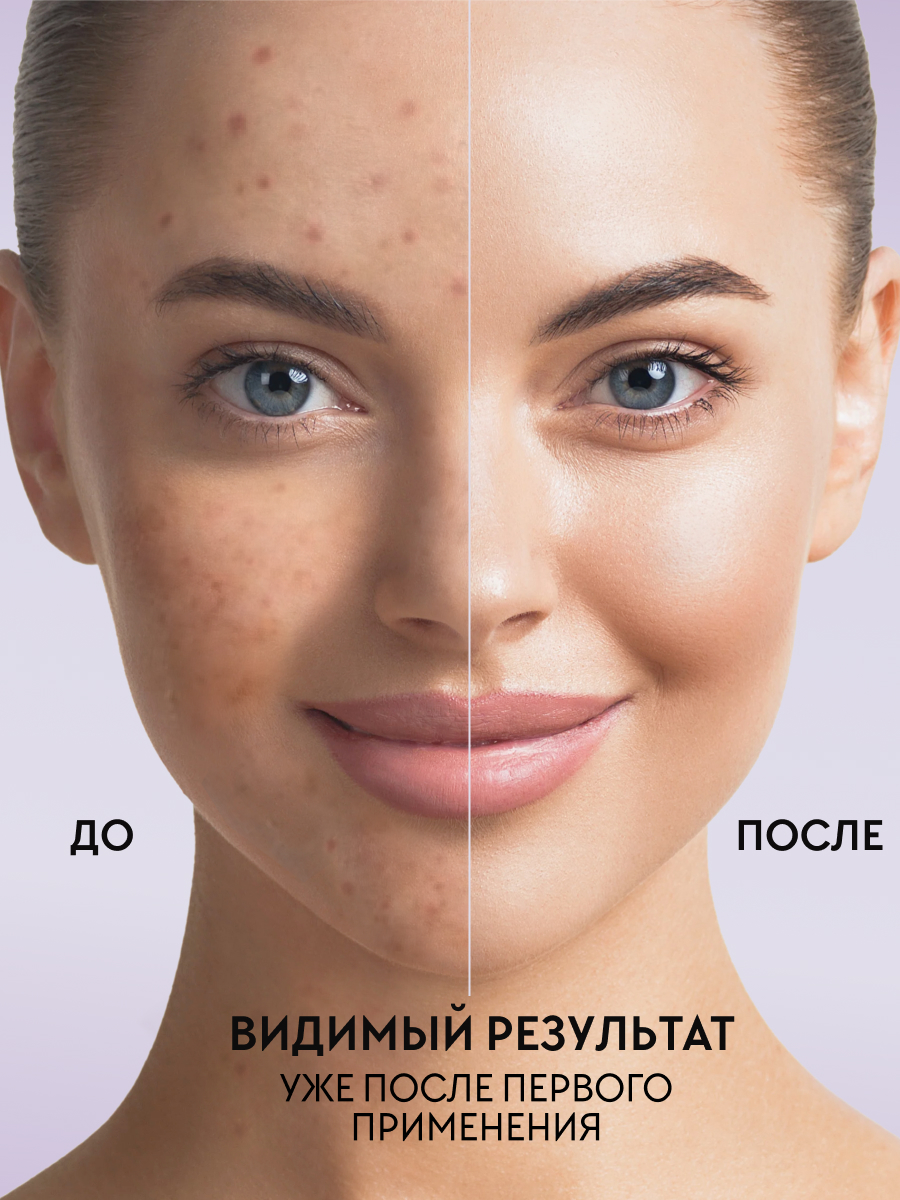 Гель для умывания жирной кожи лица, анти-акне, MOREO, 400 мл