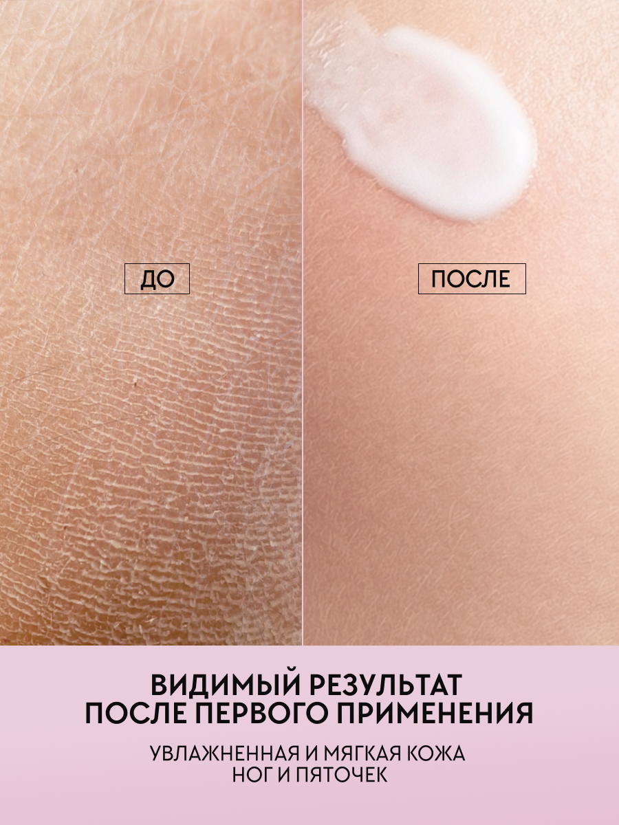 Крем для ног и пяток увлажняющий с мочевиной, MOREO, 400 мл