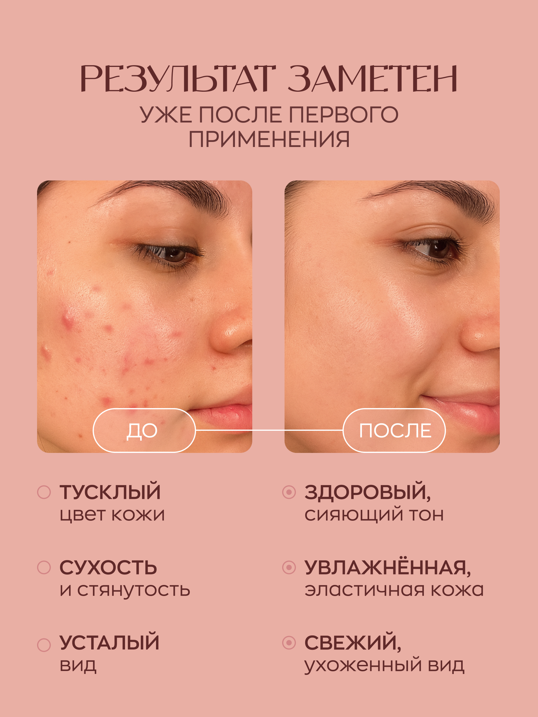 Гель для умывания лица, анти-акне, матирующий...